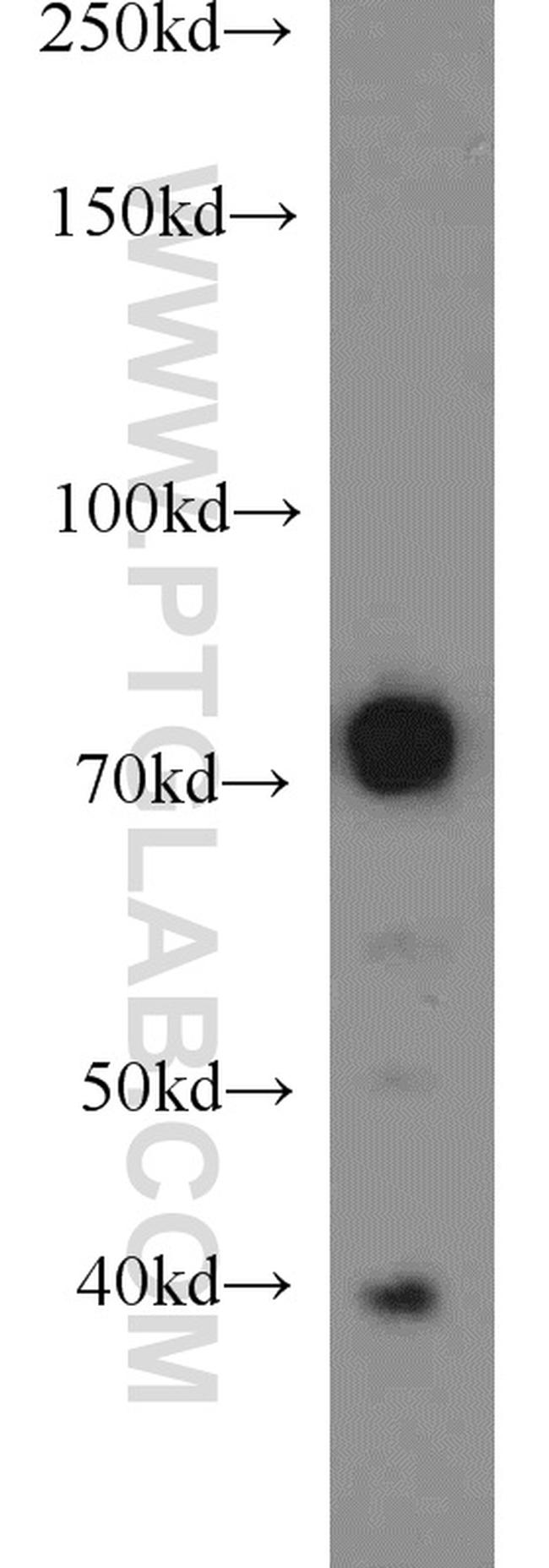 GRB10 Antibody in Western Blot (WB)