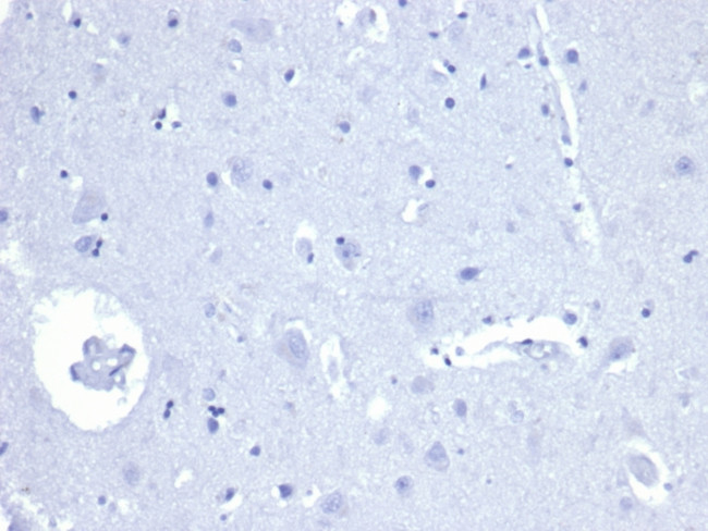 AMACR/p504S Antibody in Immunohistochemistry (Paraffin) (IHC (P))