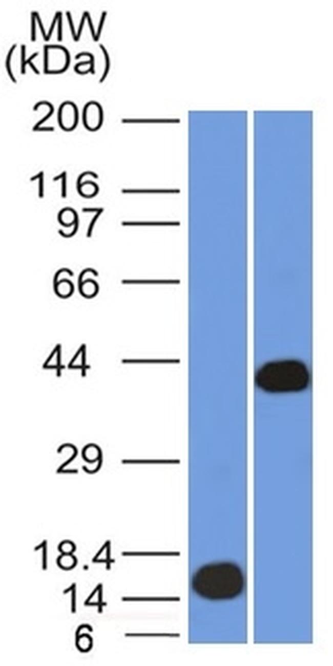 AMACR/p504S Antibody in Western Blot (WB)