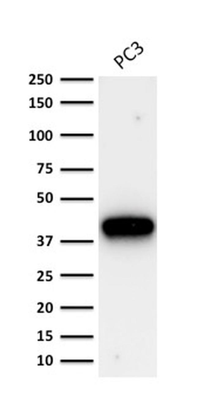 AMACR/p504S Antibody in Western Blot (WB)