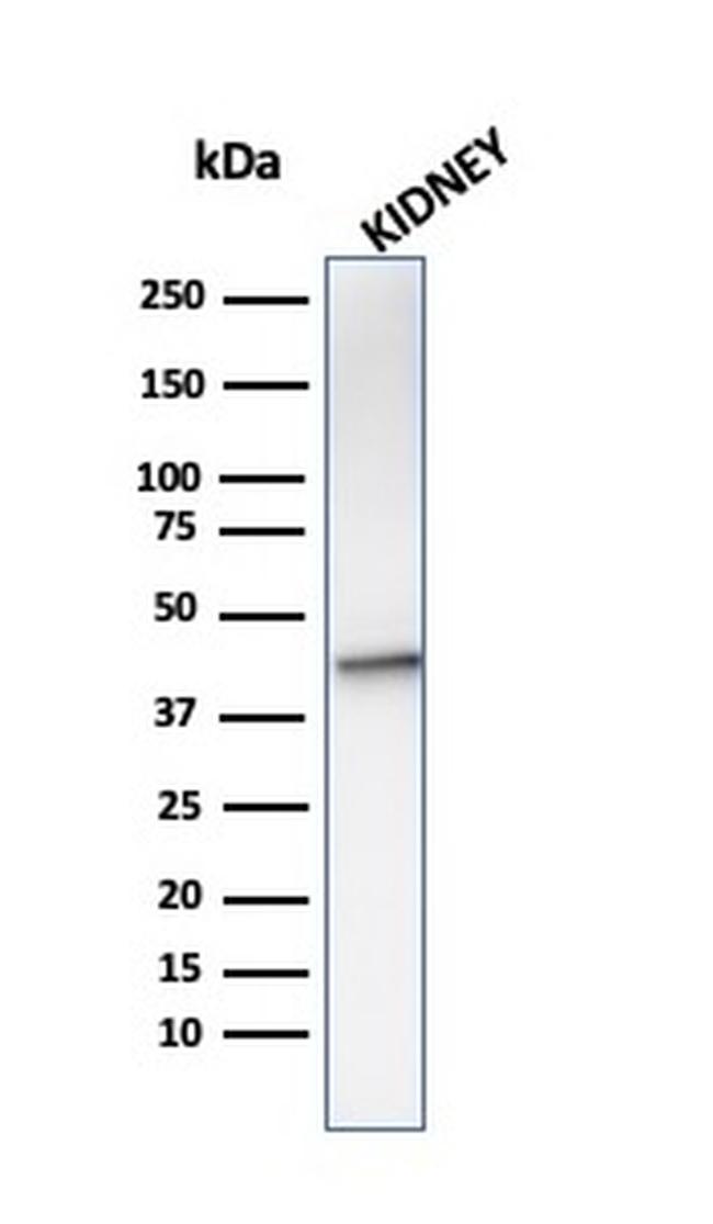 AMACR/p504S Antibody in Western Blot (WB)