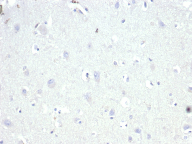 AMACR/p504S (Prostate Cancer Marker) Antibody in Immunohistochemistry (Paraffin) (IHC (P))