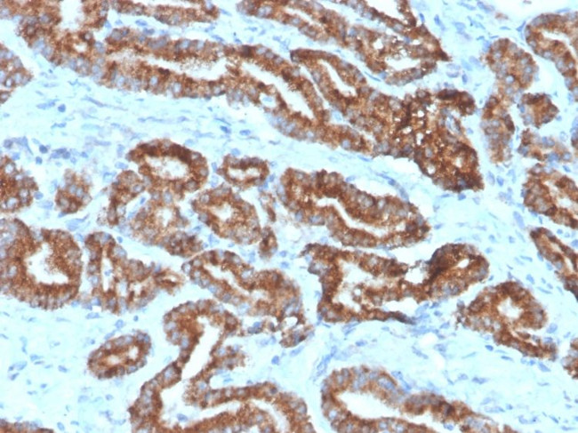 AMACR/p504S (Prostate Cancer Marker) Antibody in Immunohistochemistry (Paraffin) (IHC (P))