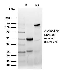 AMACR/p504S (Prostate Cancer Marker) Antibody in SDS-PAGE (SDS-PAGE)