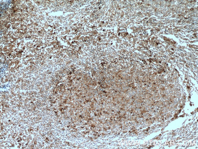 SELPLG Antibody in Immunohistochemistry (Paraffin) (IHC (P))