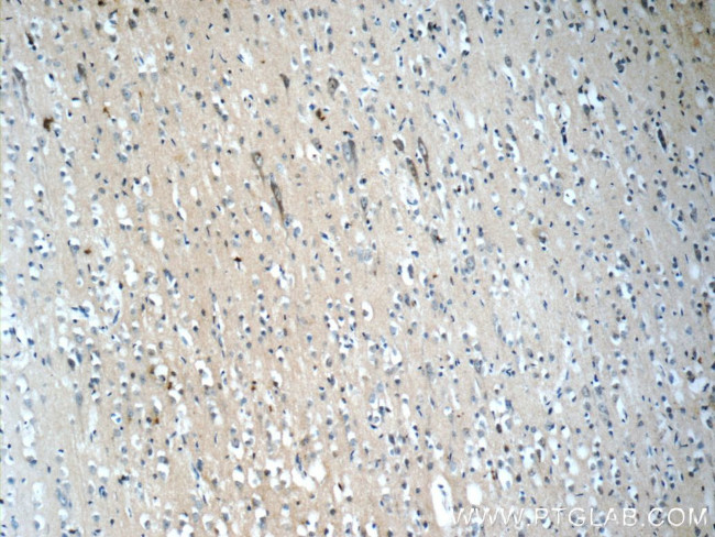 NPS Antibody in Immunohistochemistry (Paraffin) (IHC (P))