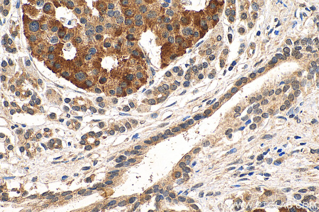 NPS Antibody in Immunohistochemistry (Paraffin) (IHC (P))