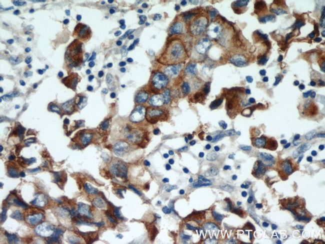 MUC1/CA15-3 Antibody in Immunohistochemistry (Paraffin) (IHC (P))