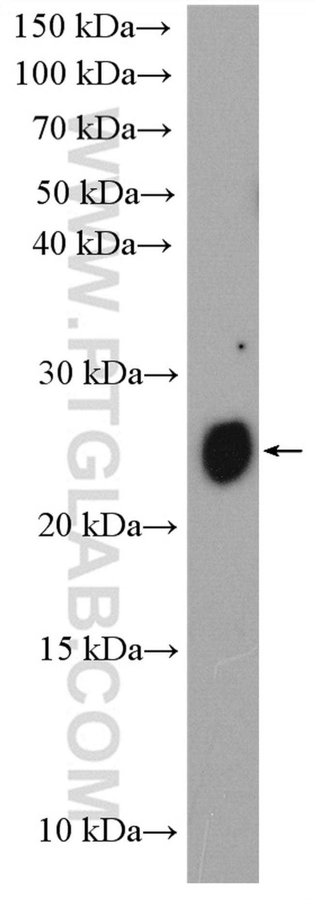 MUC1/CA15-3 Antibody in Western Blot (WB)