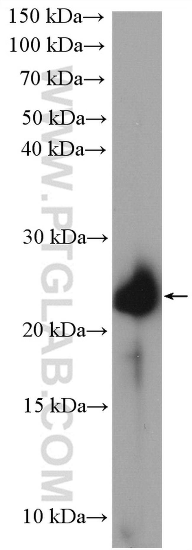 MUC1/CA15-3 Antibody in Western Blot (WB)