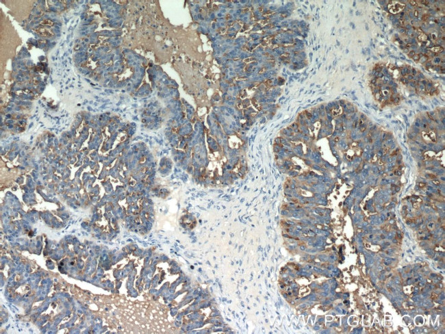 MUC1/CA15-3 Antibody in Immunohistochemistry (Paraffin) (IHC (P))