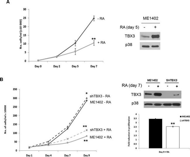 TBX3 Antibody in Western Blot (WB)