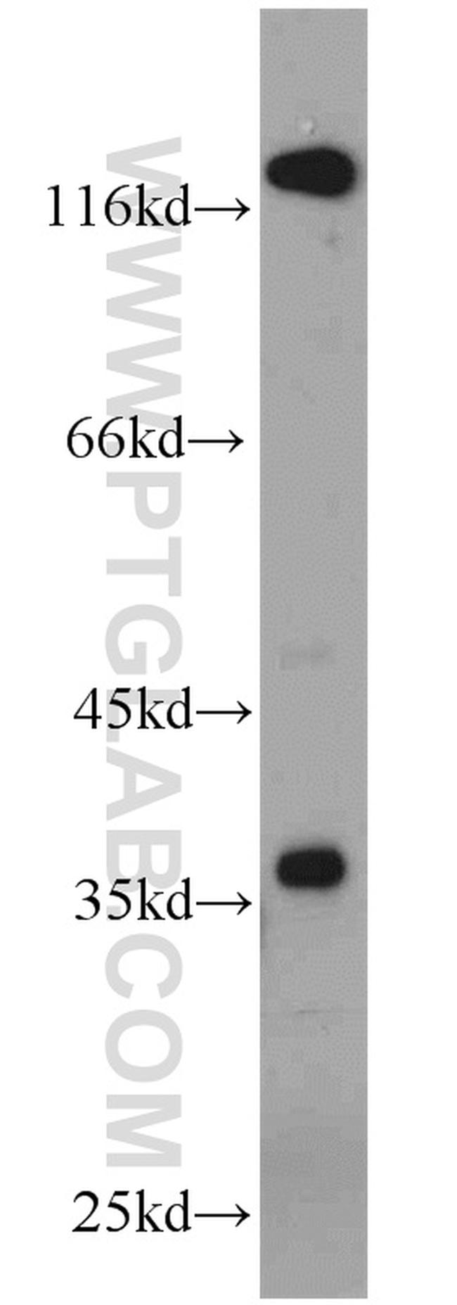 P15RS Antibody in Western Blot (WB)