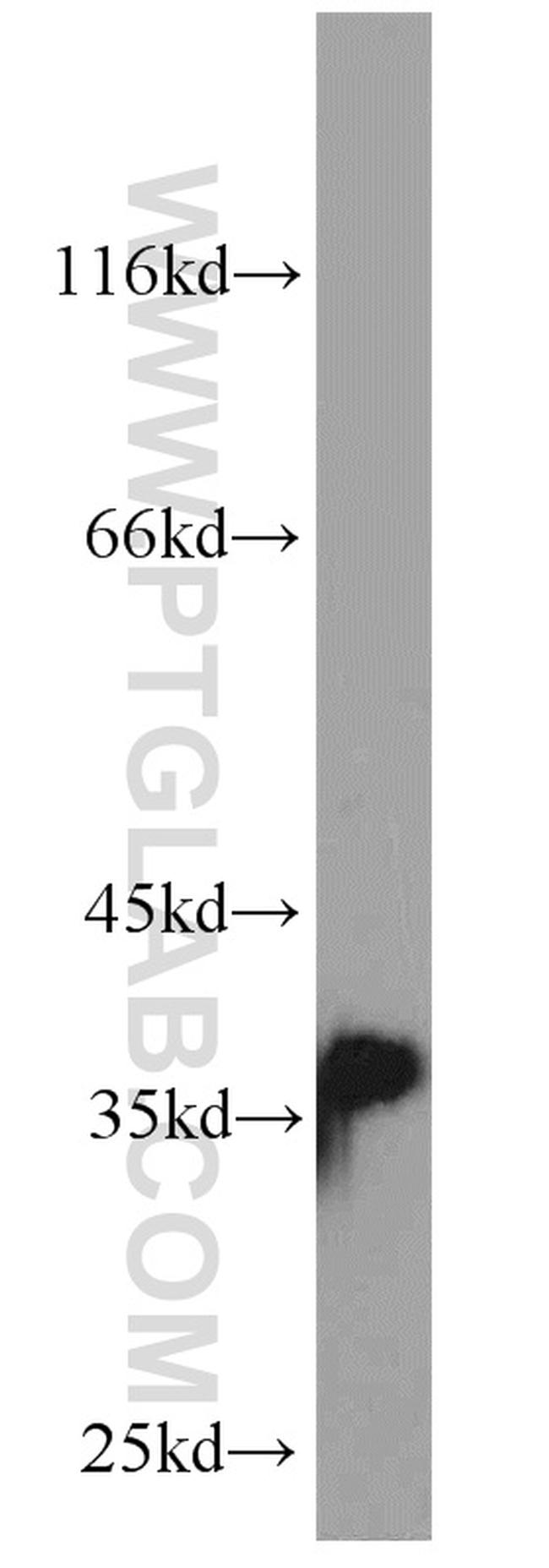 P15RS Antibody in Western Blot (WB)