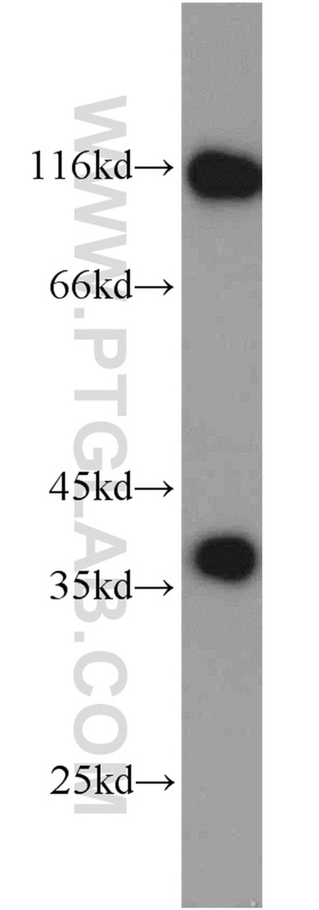 P15RS Antibody in Western Blot (WB)