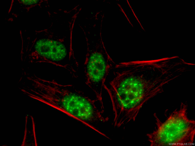 P15RS Antibody in Immunocytochemistry (ICC/IF)