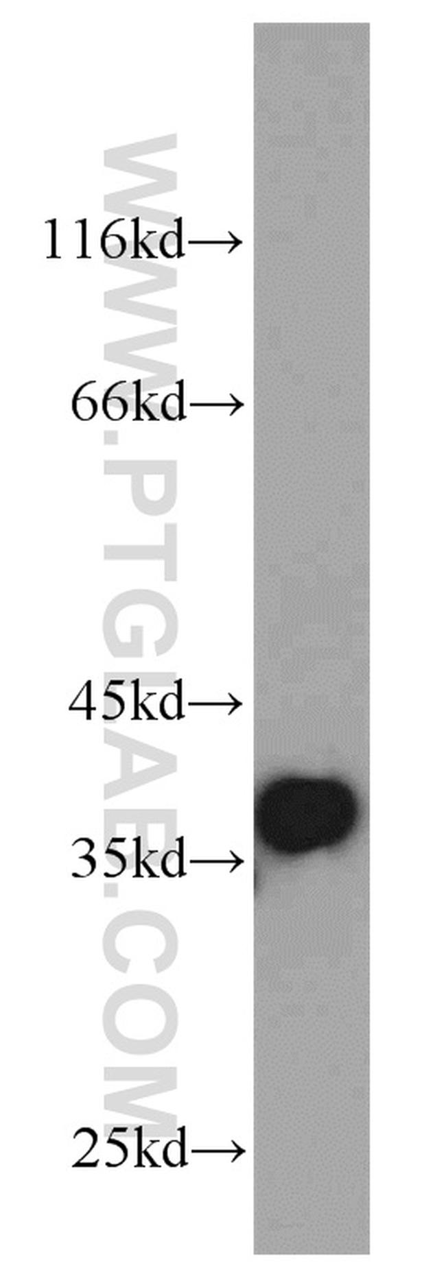 P15RS Antibody in Western Blot (WB)