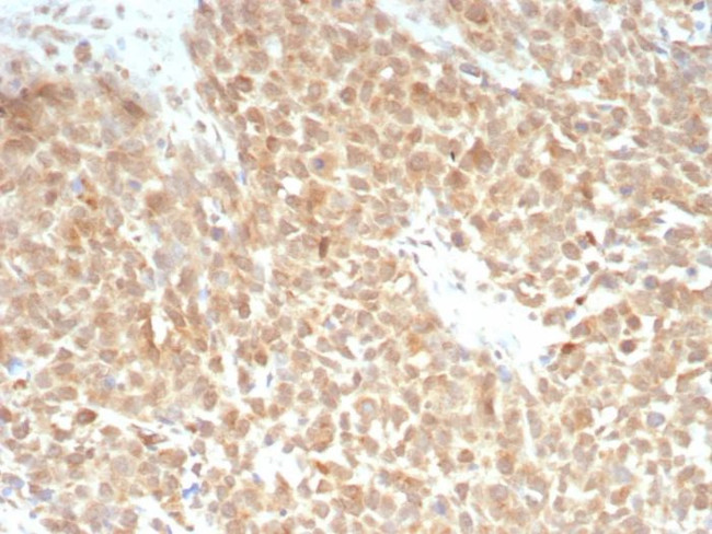 SLC7A11/xCT Antibody in Immunohistochemistry (Paraffin) (IHC (P))