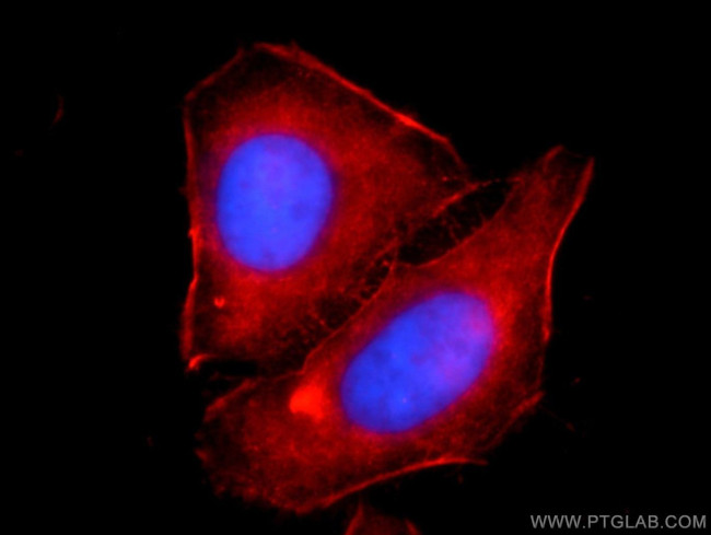 alpha Actin Antibody in Immunocytochemistry (ICC/IF)