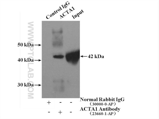 alpha Actin Antibody in Immunoprecipitation (IP)