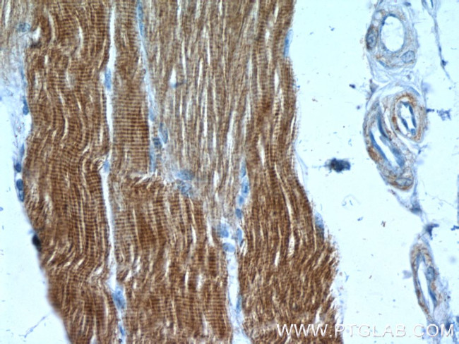 alpha Actin Antibody in Immunohistochemistry (Paraffin) (IHC (P))