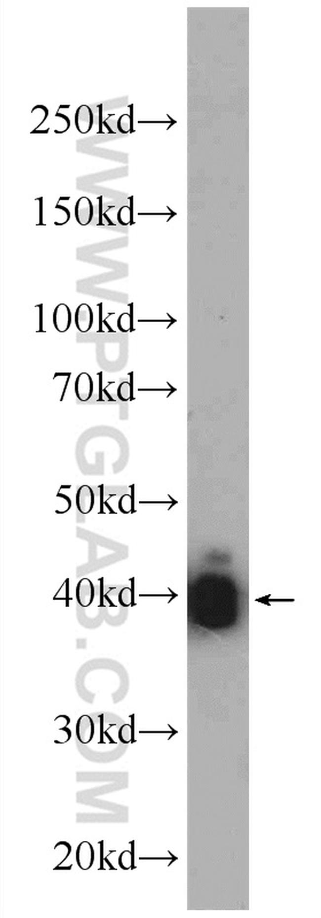 alpha Actin Antibody in Western Blot (WB)