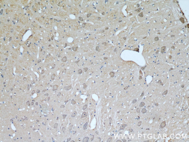 UCP1 Antibody in Immunohistochemistry (Paraffin) (IHC (P))