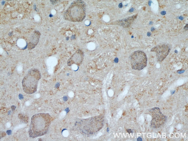 UCP1 Antibody in Immunohistochemistry (Paraffin) (IHC (P))