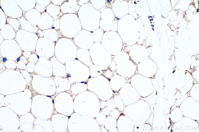 UCP1 Antibody in Immunohistochemistry (Paraffin) (IHC (P))