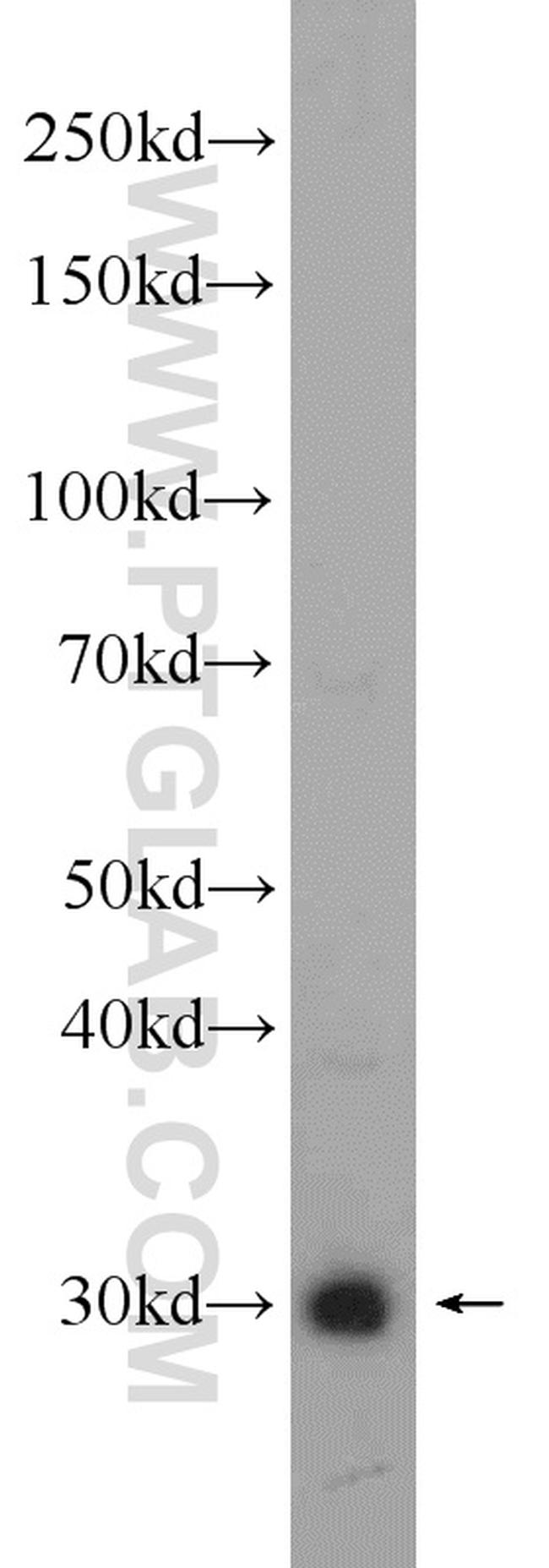 UCP1 Antibody in Western Blot (WB)