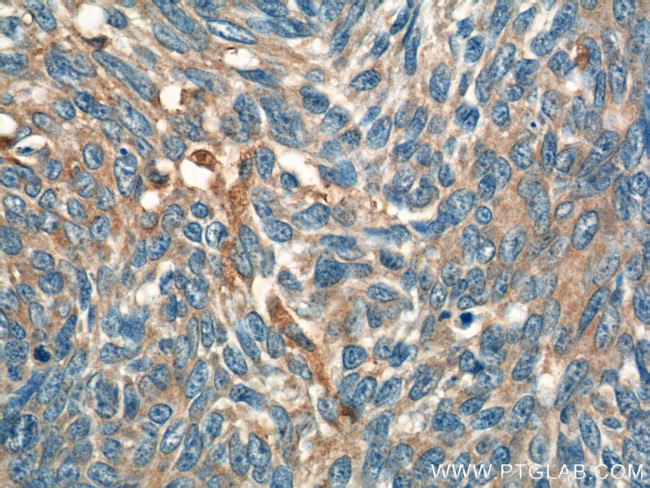 IL-19 Antibody in Immunohistochemistry (Paraffin) (IHC (P))