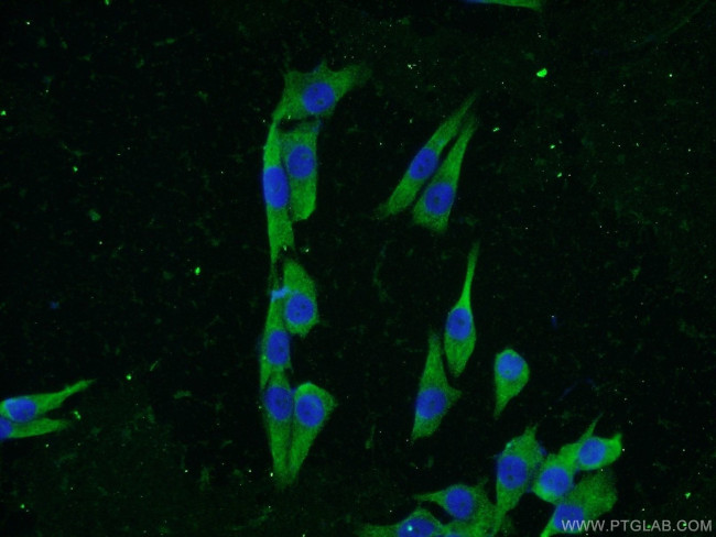 KCNK18 Antibody in Immunocytochemistry (ICC/IF)