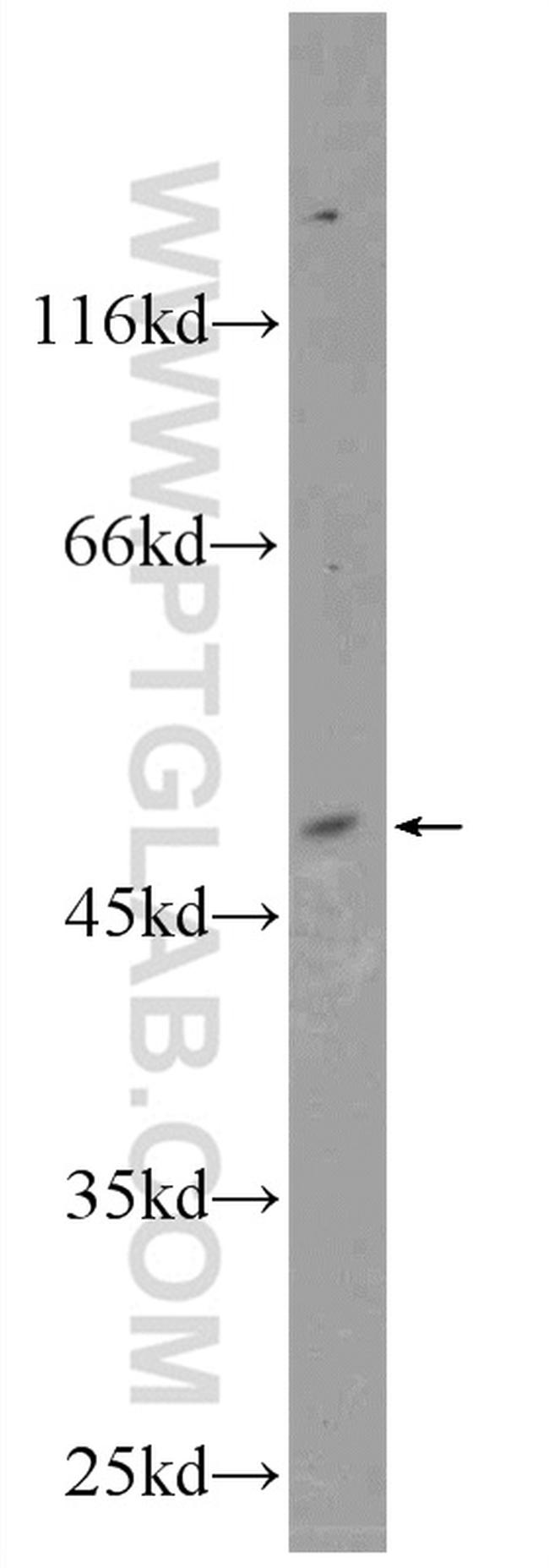 KCNK18 Antibody in Western Blot (WB)