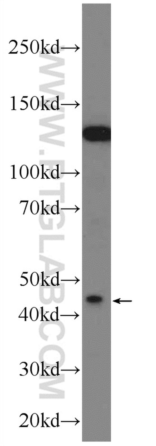 KCNK18 Antibody in Western Blot (WB)