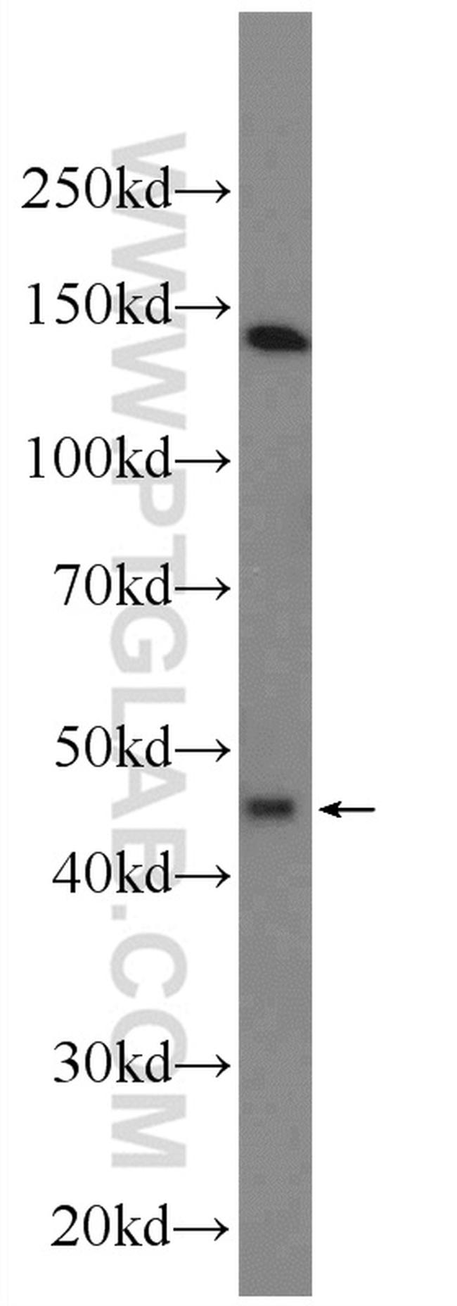 KCNK18 Antibody in Western Blot (WB)