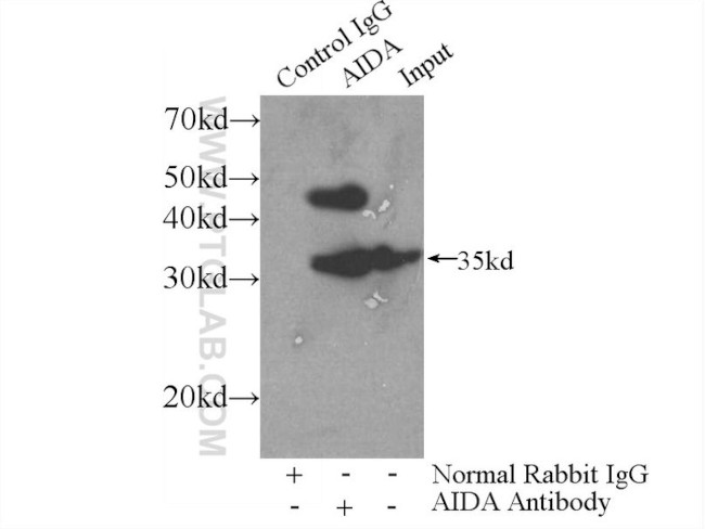 AIDA Antibody in Immunoprecipitation (IP)