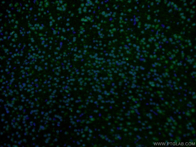 RSK2 Antibody in Immunohistochemistry (PFA fixed) (IHC (PFA))