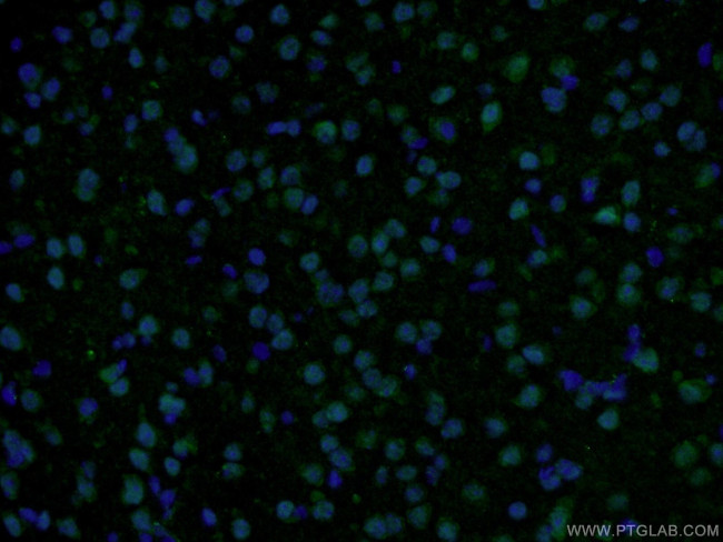 RSK2 Antibody in Immunohistochemistry (PFA fixed) (IHC (PFA))