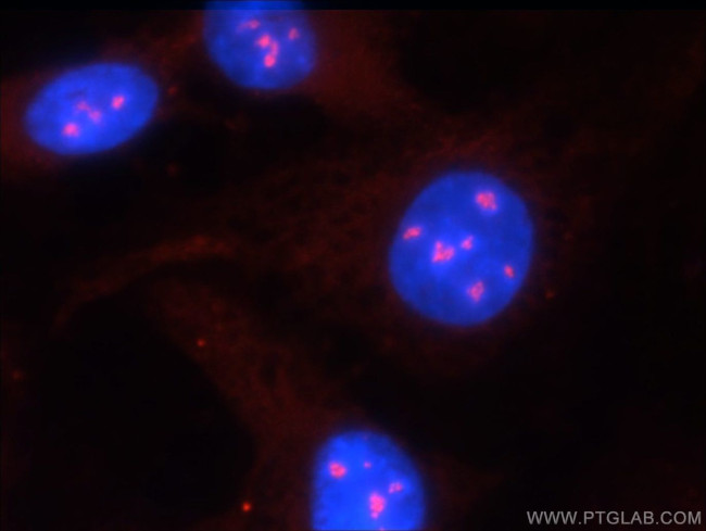 RSK2 Antibody in Immunocytochemistry (ICC/IF)