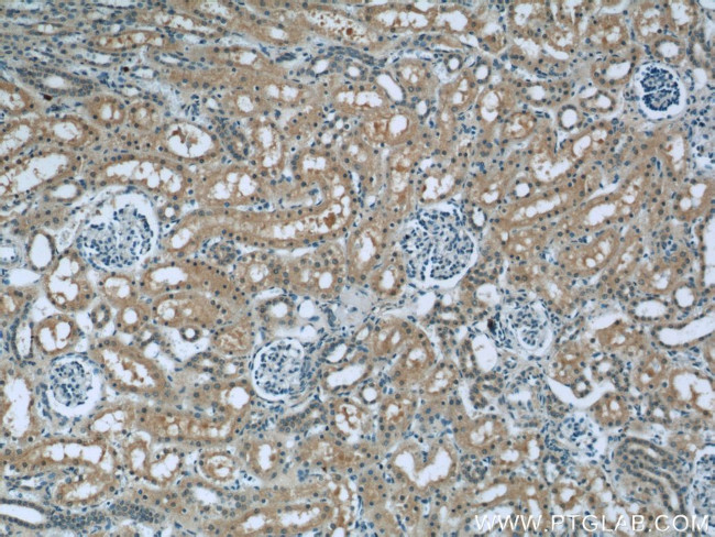 RSK2 Antibody in Immunohistochemistry (Paraffin) (IHC (P))