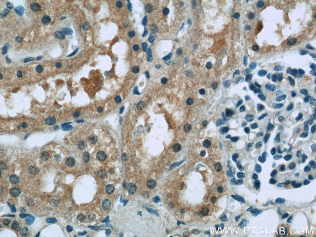 RSK2 Antibody in Immunohistochemistry (Paraffin) (IHC (P))