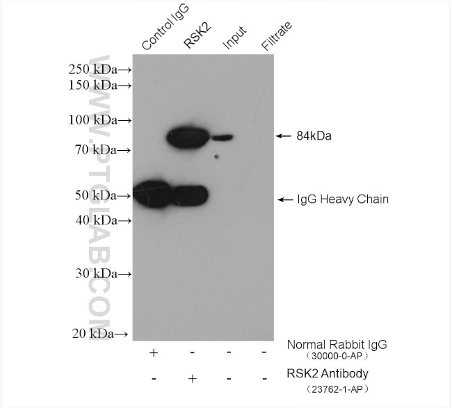 RSK2 Antibody in Immunoprecipitation (IP)