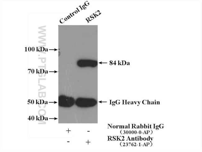 RSK2 Antibody in Immunoprecipitation (IP)