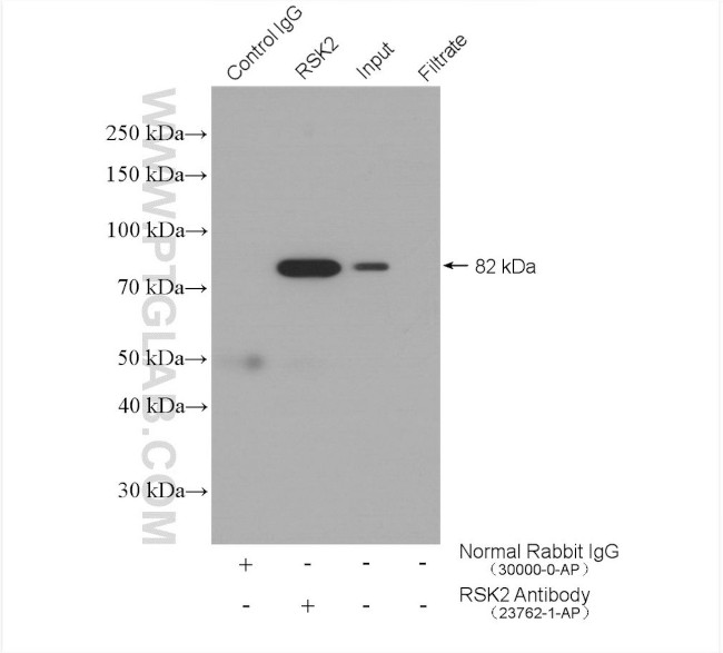 RSK2 Antibody in Immunoprecipitation (IP)