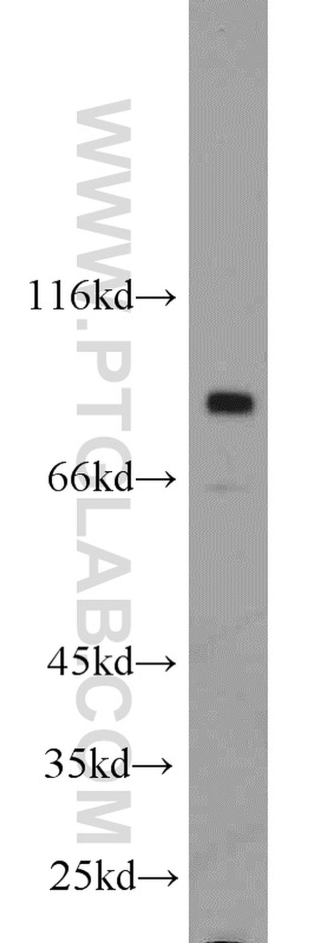 RSK2 Antibody in Western Blot (WB)