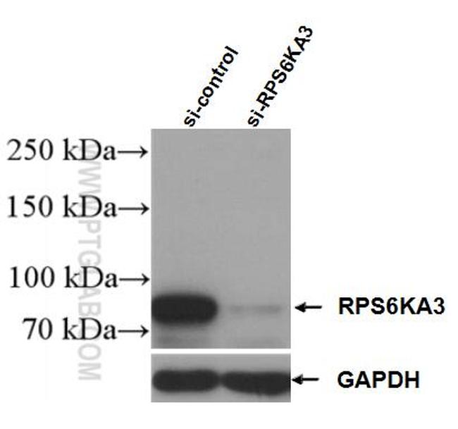 RSK2 Antibody in Western Blot (WB)