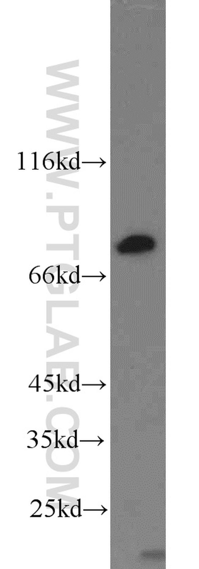 RSK2 Antibody in Western Blot (WB)