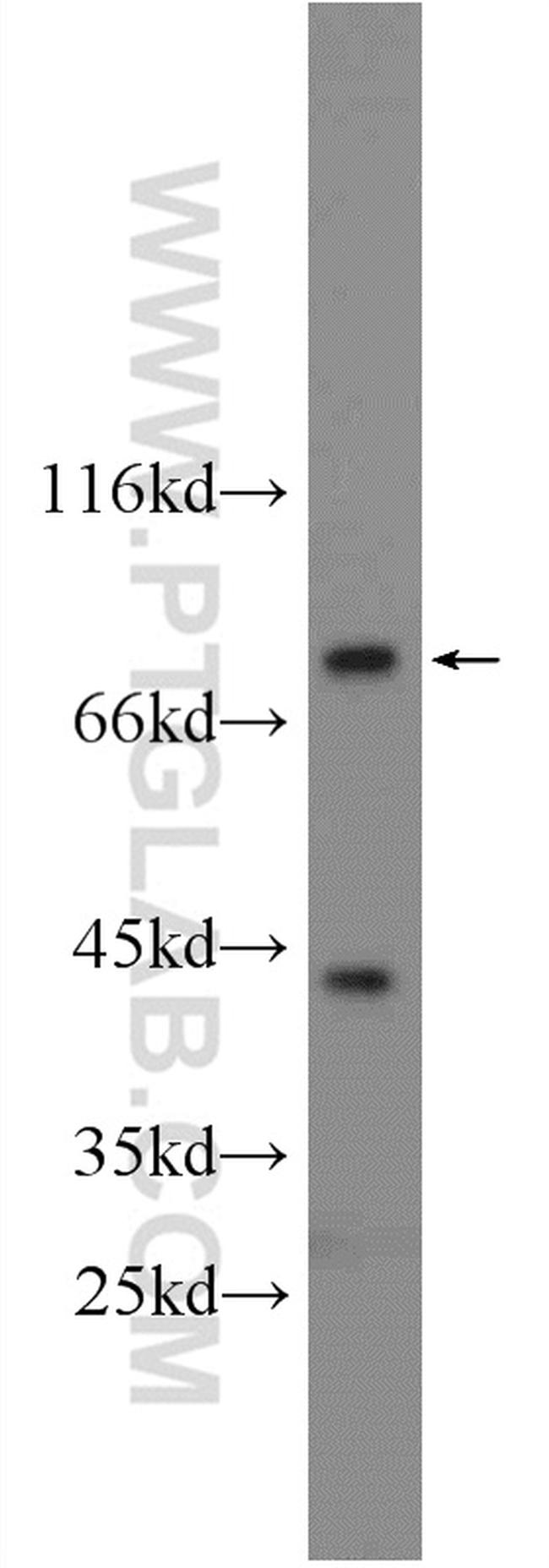 RSK2 Antibody in Western Blot (WB)