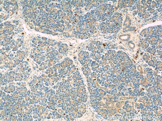 ADAM8 Antibody in Immunohistochemistry (Paraffin) (IHC (P))