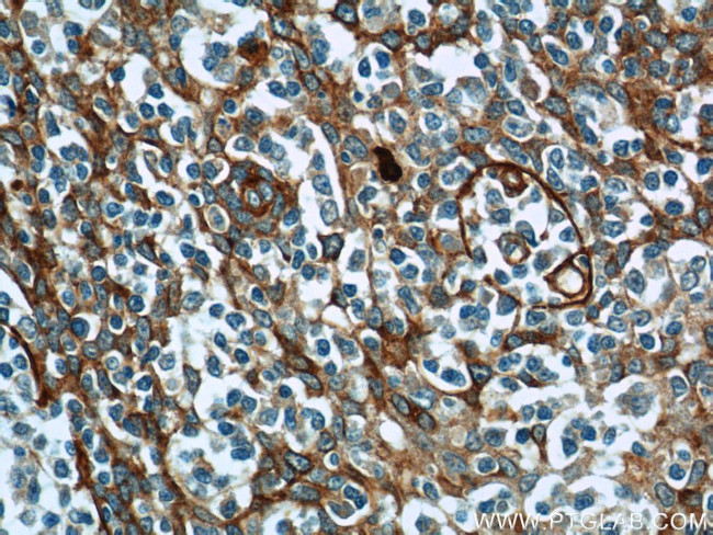 ADAM8 Antibody in Immunohistochemistry (Paraffin) (IHC (P))